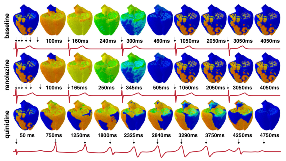 heart simulation